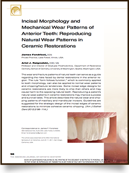 Incised Morphology and Mechanical wear Patterns of Anterior Teeth: Reproducing Natural Wear Patterns in Ceramic Restorations article at Aesthetic Restorative & Implant Dentistry Northwest